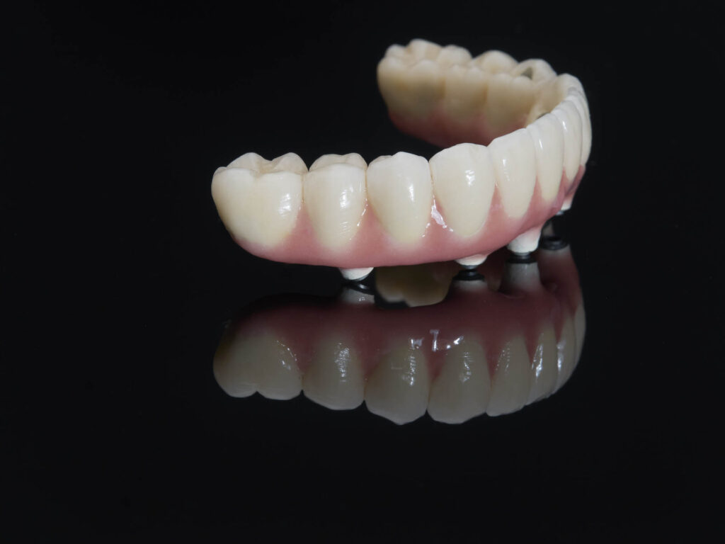 implant crowns